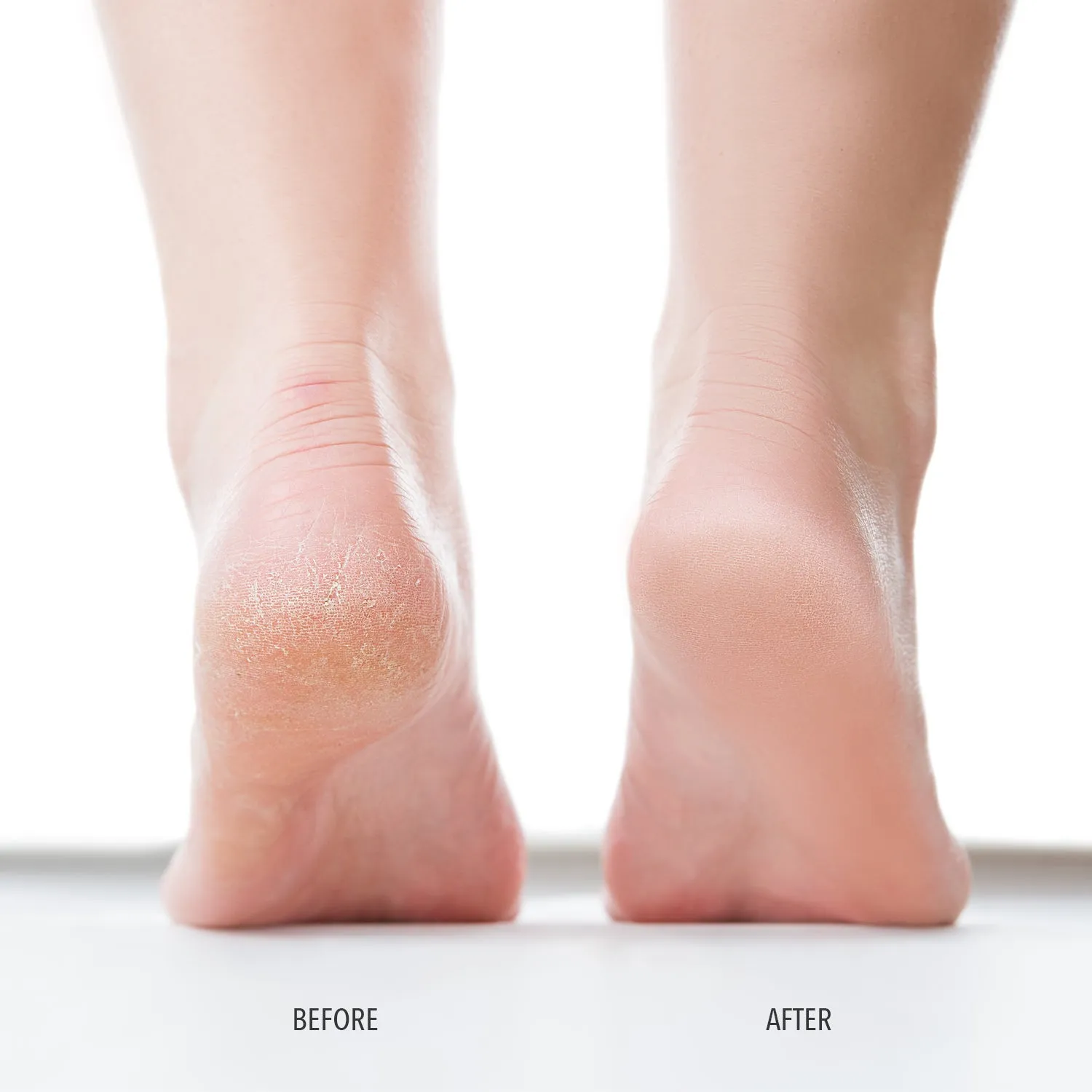Londontown - Foot Scrub